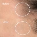 필소프트 | [여주 피부관리] 메디스킨 유리하 &#39;소프트플래닝&amp;칵테일필&#39; 관리 후기