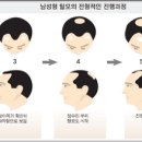 그레이스위그
