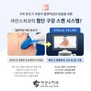 예우치과기공소 | 장안동치과 만성치주염 임플란트로 깔끔하게 개선한 case