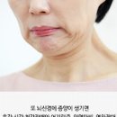 뇌 종양 초기 증상 뇌종양 초기 증상 뇌종양 원인 증상 이미지