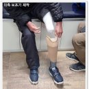 의족보조기센터 이미지