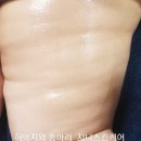 지나비만관리실
