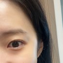 아이디안경 위드렌즈 달동점 이미지