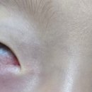 눈에힘안과의원 이미지