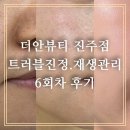 [진주피부관리]여드름피부에 강추하는 진정 재생관리 더안뷰티 진주점 후기