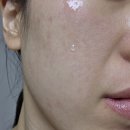 포어리스딥클렌징오일 맥스클리닉 올리브영추천템 블랙헤드제거