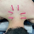 연세참한의원 이미지