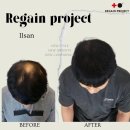 리게인프로젝트 이미지