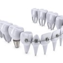 맑은플란트치과의원 이미지