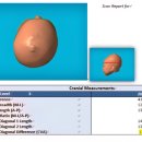 기임빌딩 | 아기 두상교정헬멧 지오헬멧 후기(추천인 이벤트)