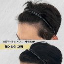 헤어라인 이미지