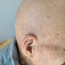 렉스톤 보청기 양천지사 이미지