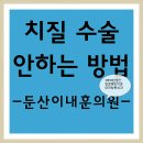 치질수술 안하는 방법-(대전항문외과치질병원-둔산이내훈의원) 이미지