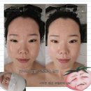 필413 | 청량리 피부관리 더작 청량리점 작은얼굴관리 후기