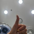 프라이드성형외과의원 | 신사역 프라이드성형외과 문신제거 타투제거 5회차