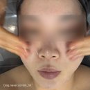 전주 효자동 피부관리, 리켄스킨랩에서 깐달걀 피부관리 세멘시트관리 후기!