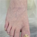 동성약국 | 대전 둔산동 발톱무좀 문제성발톱 전문적으로 잘하는 곳 페디쿱스 동성풀리메디