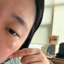겨드랑이색소침착 추천 :: 허요케 나이데카 착색크림 솔직후기