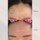 리누에스테틱 이미지