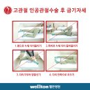 ※ 고관절인공관절 수술 후 주의사항 및 금기자세 (인공관절수술잘하는곳 :: 고관절수술 인공관절치환술 후 관리) 이미지