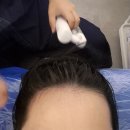 시청동로 | 화성두피관리 두피밥 화성시청점 두피스케일링 워터테라피 후기