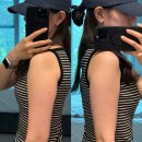 주식회사 다온다옴 | 강남 바디온다리프팅 팔 가격 및 효과 내돈내산 솔직후기