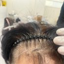 포돌이길 | [에이원스칼프] 경기광주 탈모케어'두피문신' 전문점 이용 대만족 후기