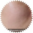 스텔라의원 네이버블로그