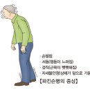 파킨슨병 의정의 이미지