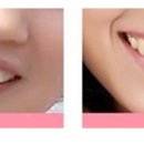 삼성동-6 이미지