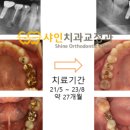 샤인치과교정과 치과병원 이미지