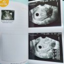 매곡보건지소 | :임신초기정보: 대구 보건소 임신축하선물과 로즈맘 산부인과 진료후기👏