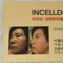 고은인셀덤