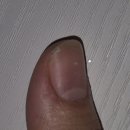 쉽게 잘 깨지는 손톱을 위한 최고의 선택, 케라셀 네일 (Kerasal nail) 리뷰