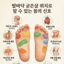 발바닥 굳은살 위치로 알 수 있는 몸의 신호 이미지