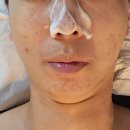 안성 피부관리 석정동 아리스민뷰티 물방울리프팅 후기