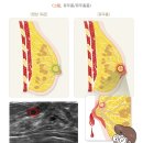 그레이스셀강남병원 이미지