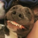 구말피 | 구강전정술(거미스마일 잇몸성형) 내돈내산 후기글, 잇몸공주들을 위한 후기입니다