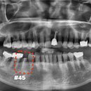 수원탑플란트치과의원 이미지