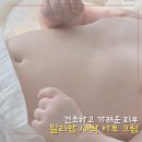 건조하고 가려운 아기피부 고보습 밀리맘 새싹아토크림 솔직후기