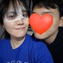 웅이안경 | 밝은성모안과의원 렌즈삽입술 후기(라섹 재수술이었던것)