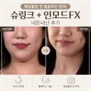 웨딩촬영 전 얼굴관리 후기｜슈링크 300샷 + 인모드FX 솔직 리뷰