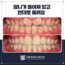 분당퍼스트치과의원 네이버블로그