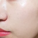 바른메디케어 이미지