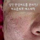 더고운피부 이미지