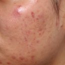 예한의원 이미지