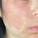 아토피랑 맞짱 뜨기 1편 (아토피 화장품 리뷰-청대밤, 골드스프레이, 아토뮤, 김정문 알로에)