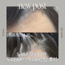 디엠헤어(D:M hair) - 94112 | 부평 두피문신 헤어라인 SMP 자연스럽고 안아프게 받은 후기