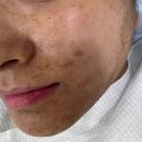 유포리아 에스테틱 이미지