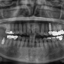 마노메디칼 이미지